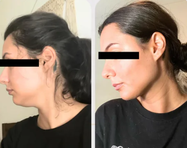 FaceSculpt – Masque V-Line Affinant Double Menton + Protocole Reset 14Jours (PDF)