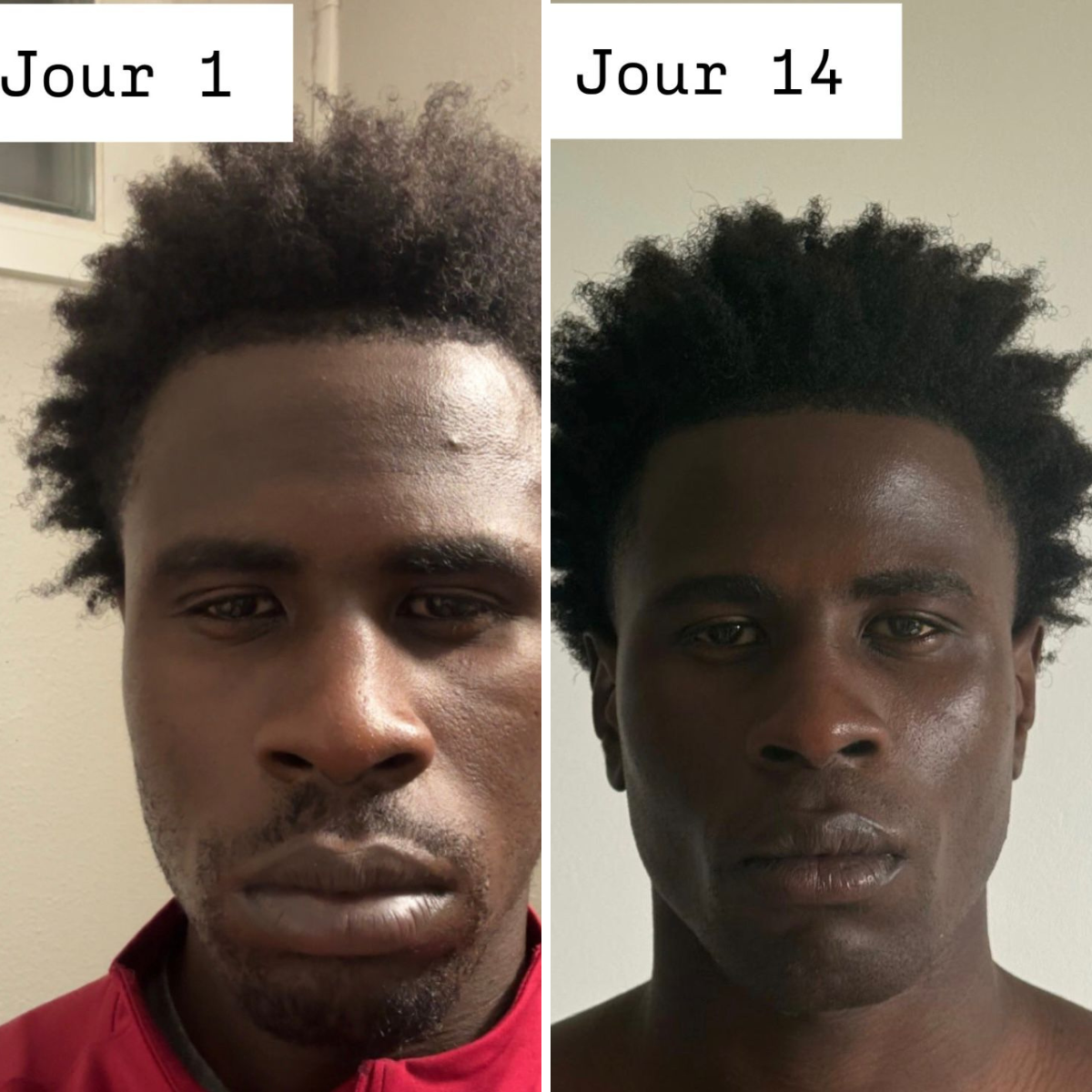 FaceSculpt – Masque V-Line Affinant Double Menton + Protocole Reset 14Jours (PDF)